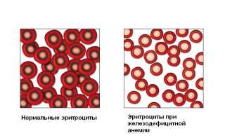 Причины пониженной температуры после гриппа