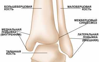 Перелом голеностопного сустава