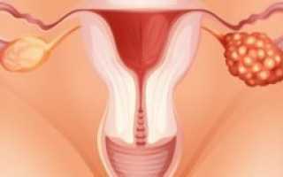 Опасность артериальной гипертензии при беременности