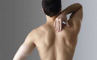 Вывих плечевого сустава