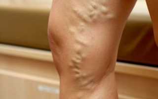 Почему возникает боль в ногах и как ее лечить