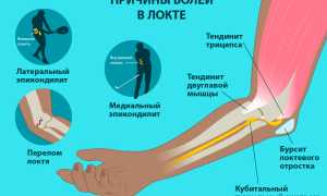 Артрит локтевого сустава