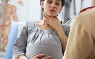 Как бороться с кашлем при беременности?