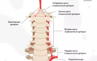 Артроз шейного отдела позвоночника