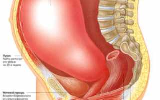 Врастание плаценты в рубец на теле матки: опасная патология
