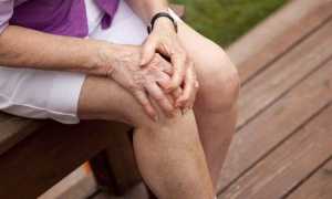 Болезнь Кенига коленных суставов