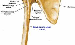 Перелом плечевой кости