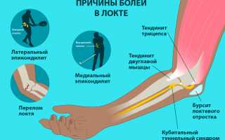 Артрит локтевого сустава – симптомы и лечение заболевания