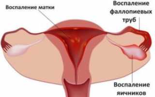 Варикоз матки: медикаментозные и хирургические методы лечения