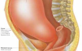 Гипертонус передней стенки матки при беременности