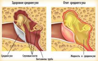 Какие антибиотики принимать при простуде и гриппе