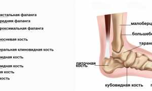 Перелом большого пальца ноги