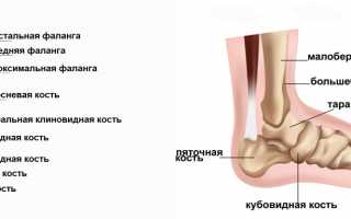 Перелом большого пальца ноги