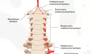 Унковертебральный артроз шейного отдела позвоночника