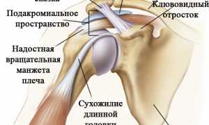 Лечение боли в плечевом суставе